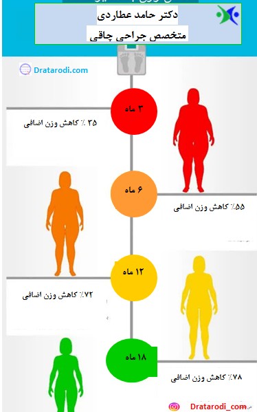 آیا بای‌پس معده عوارض دارد+چه آمپولی برای لاغری خوب است+آیا بالون معده عوارض دارد+نظرات درباره بالون معده